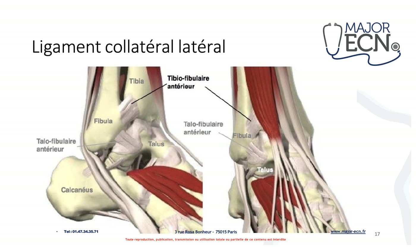 Planche de cours Major ECN — ligament collatéral latéral de la cheville